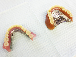 カウンセリング